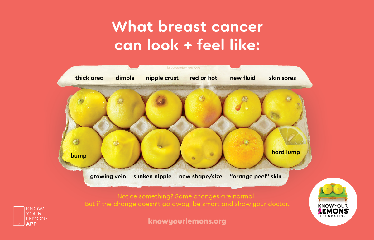 What breast cancer can look like